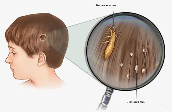 В отделе медико-социальной помощи состоялось плановое занятие на тему "Педикулез".
